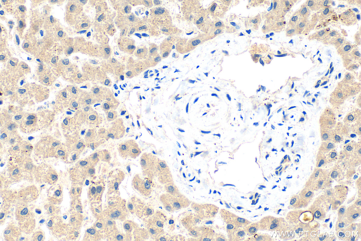 IHC staining of human liver using 30844-1-AP