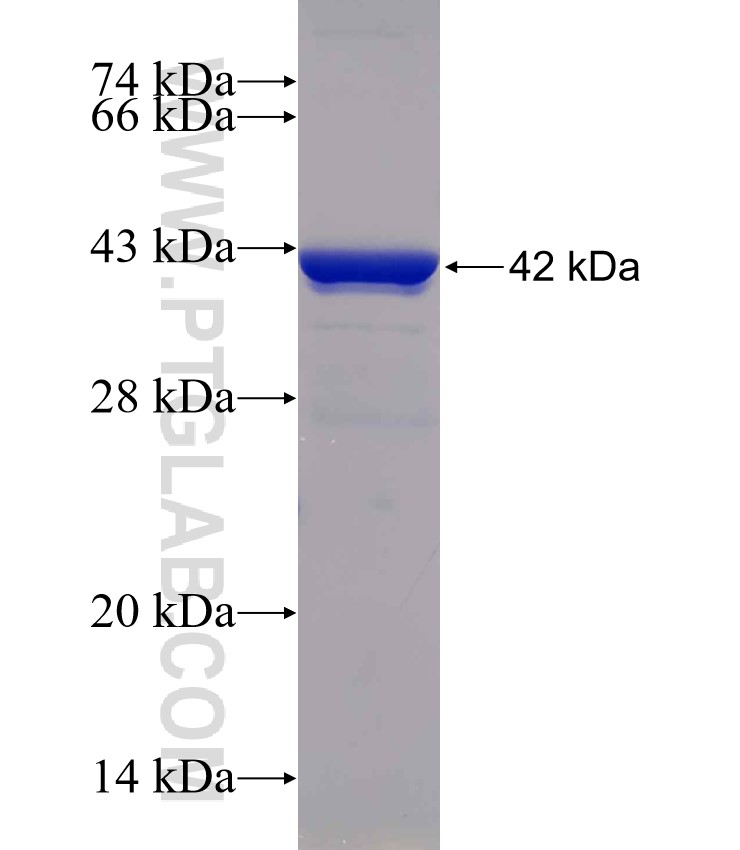 C1D fusion protein Ag30632 SDS-PAGE C1D fusion protein Ag30632 SDS-PAGE