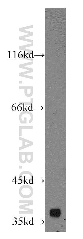 WB analysis of HeLa using 19254-1-AP (same clone as 19254-1-PBS)
