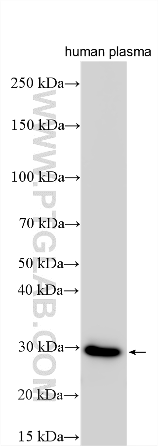 WB analysis using 11602-1-AP
