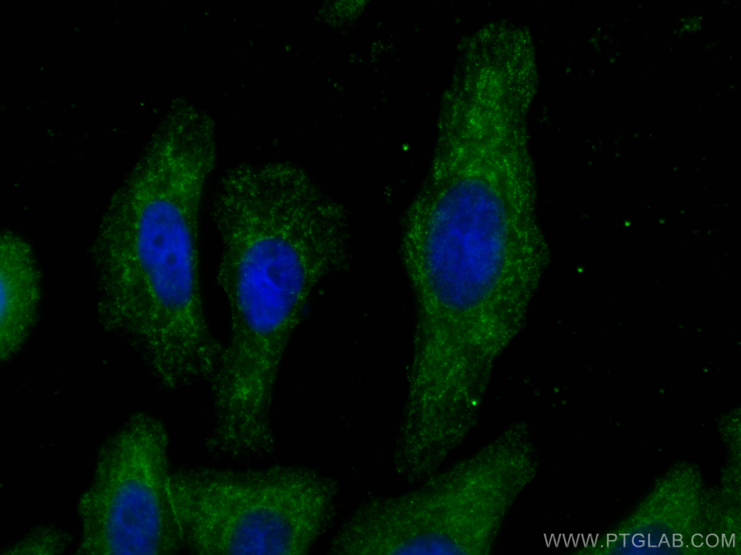 IF Staining of HepG2 using 67063-1-Ig (same clone as 67063-1-PBS)