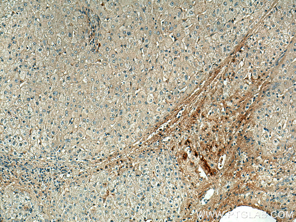 IHC staining of human liver using 67063-1-Ig (same clone as 67063-1-PBS)