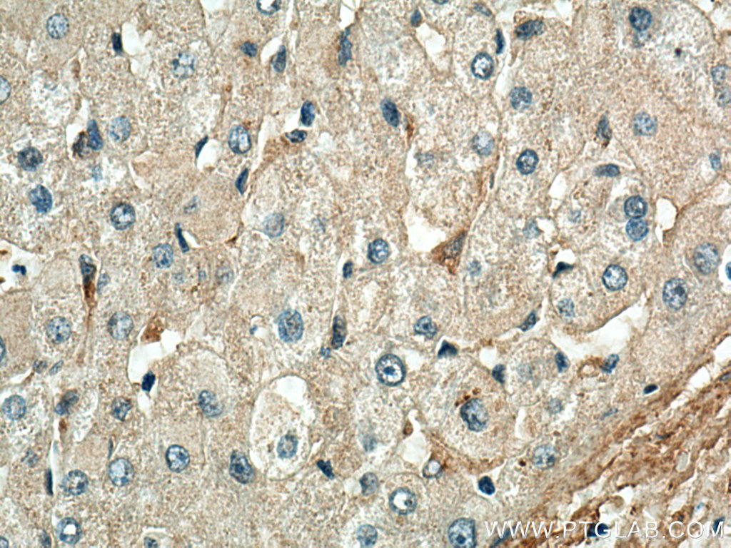 IHC staining of human liver using 67063-1-Ig (same clone as 67063-1-PBS)
