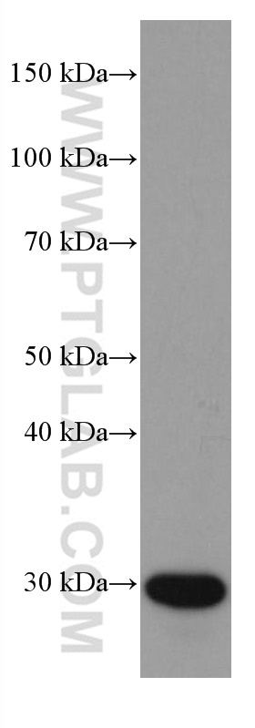 WB analysis of human plasma using 67063-1-Ig (same clone as 67063-1-PBS)