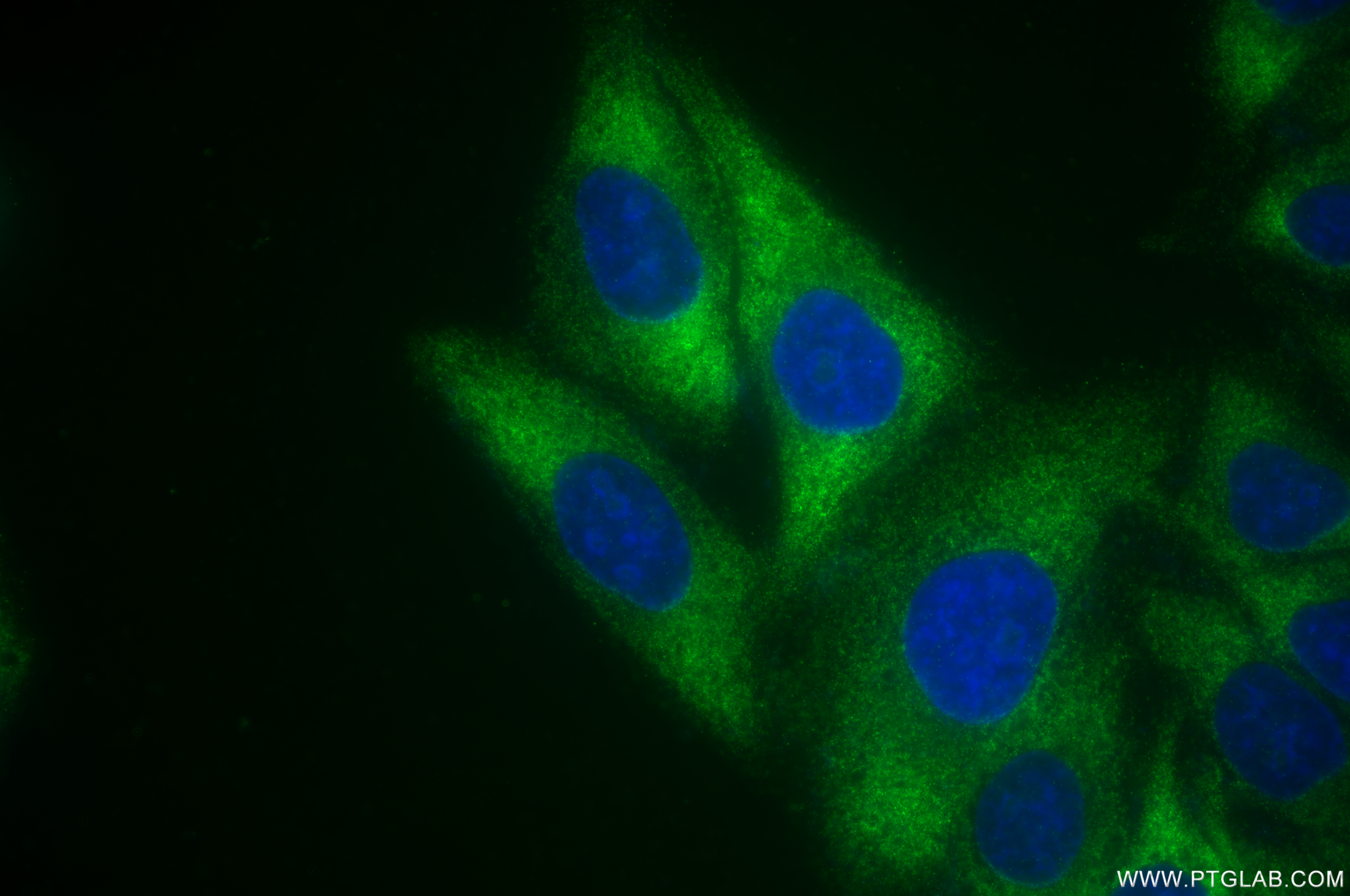 IF Staining of HepG2 using 85719-4-RR (same clone as 85719-4-PBS)