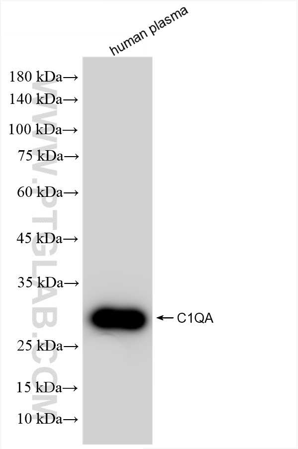 WB analysis using 85719-5-RR (same clone as 85719-5-PBS)