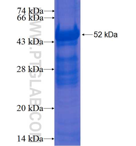 C1QA fusion protein Ag2141 SDS-PAGE