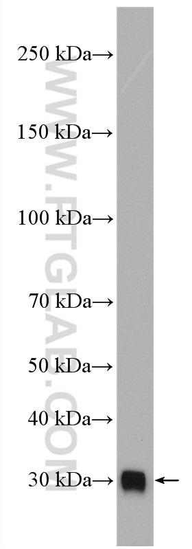 WB analysis of human plasma using 16919-1-AP