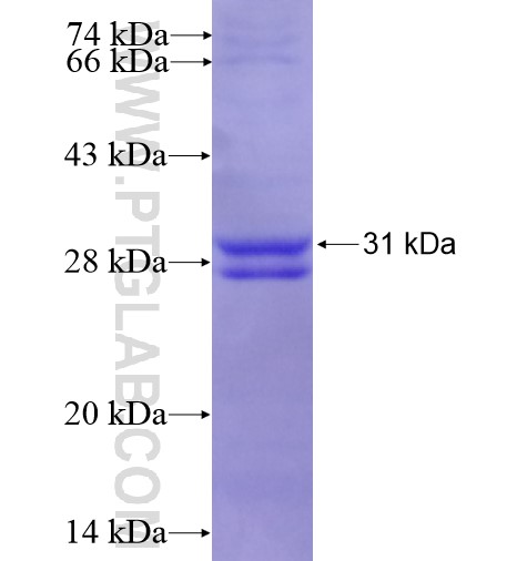 C1QB fusion protein Ag10622 SDS-PAGE C1QB fusion protein Ag10622 SDS-PAGE