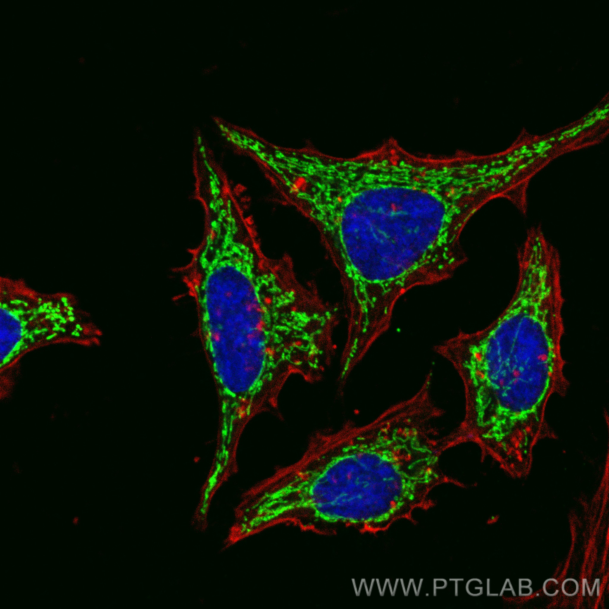 IF Staining of HeLa using 80490-1-RR