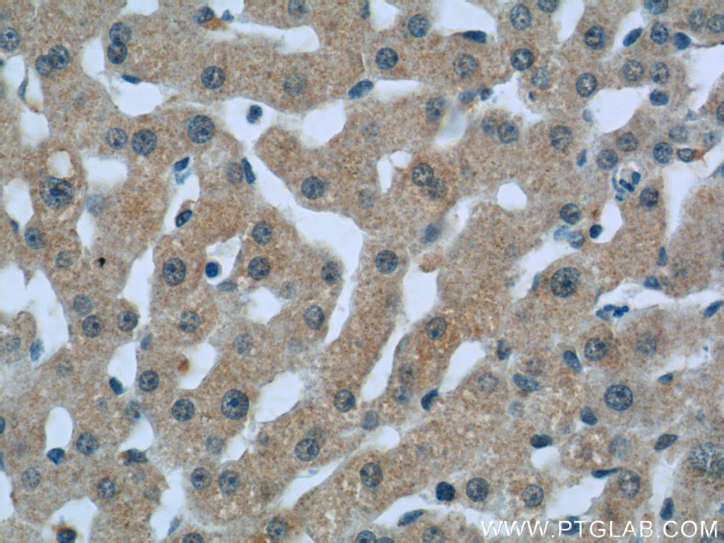 C1qC Polyclonal antibody