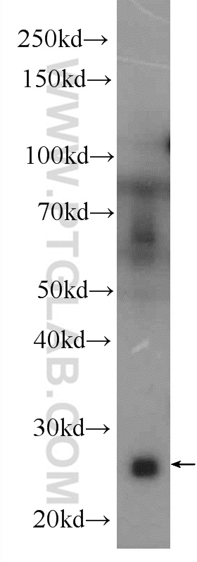 C1qC Polyclonal antibody