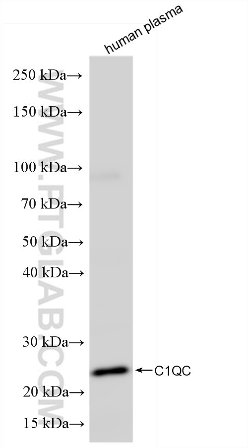 WB analysis of human plasma using 85031-5-RR