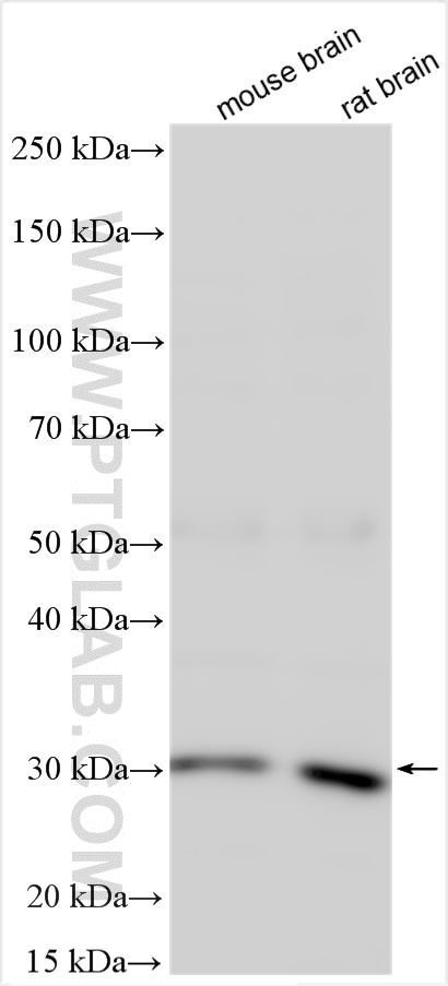 WB analysis using 15757-1-AP