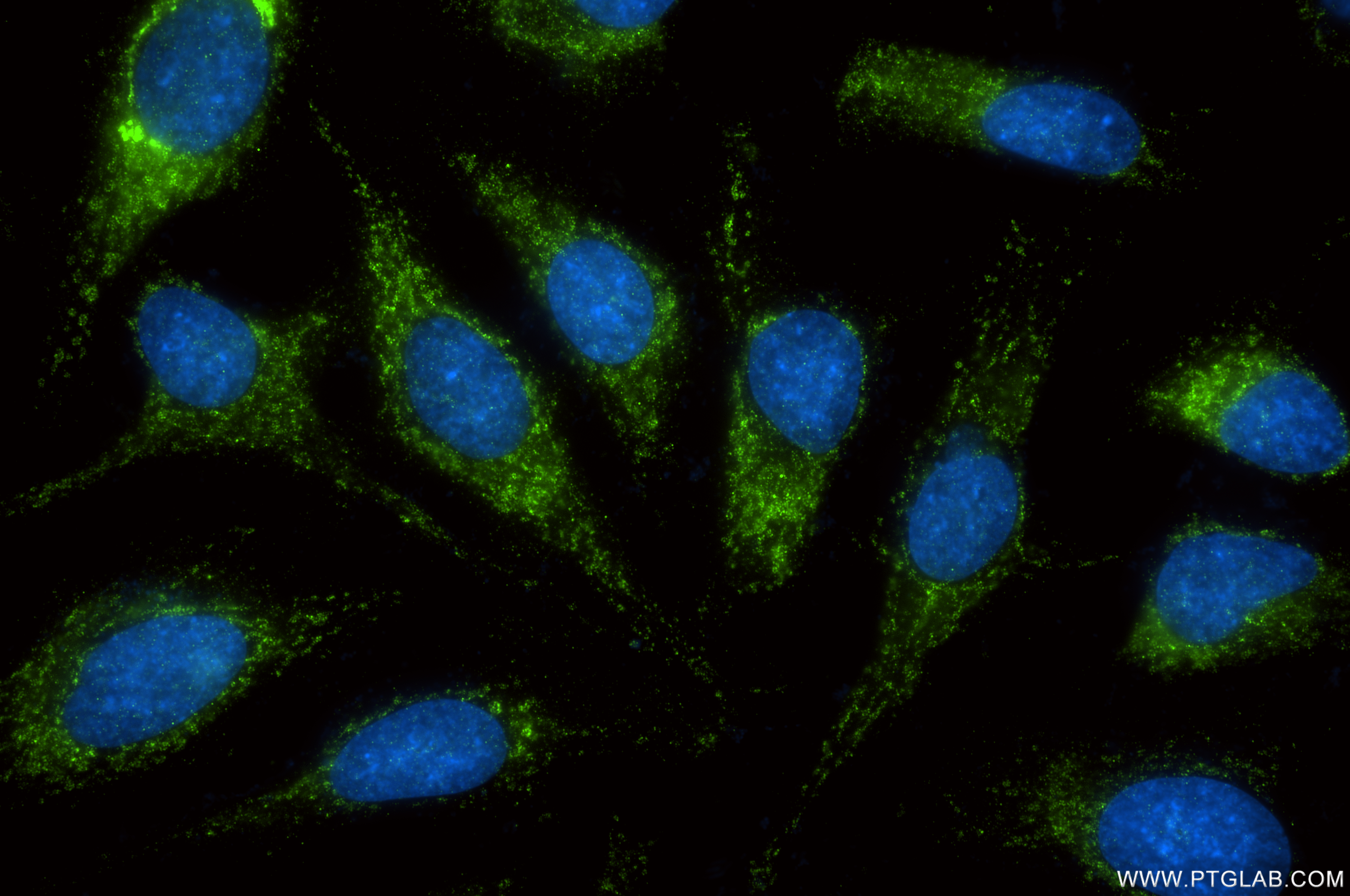IF Staining of HeLa using 87797-1-RR IF Staining of HeLa using 87797-1-RR