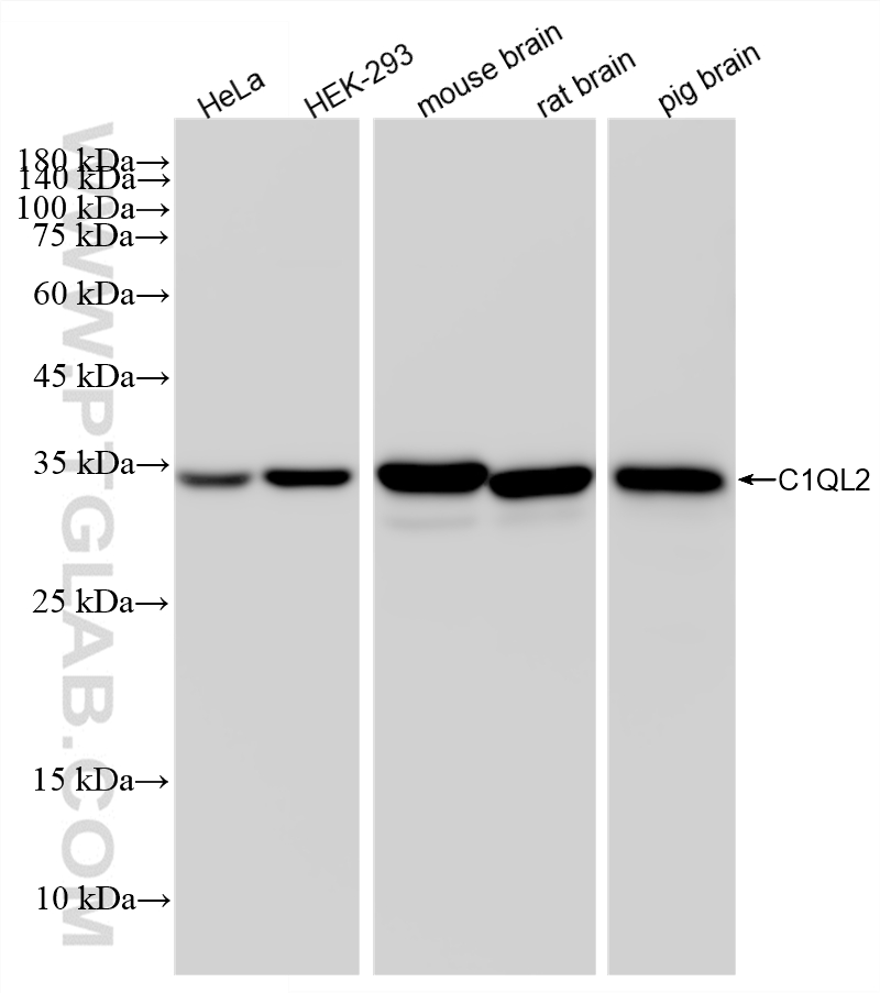 WB analysis using 87797-1-RR WB analysis using 87797-1-RR