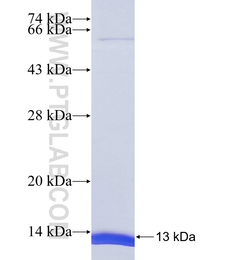 C1QL3 fusion protein Ag37421 SDS-PAGE C1QL3 fusion protein Ag37421 SDS-PAGE