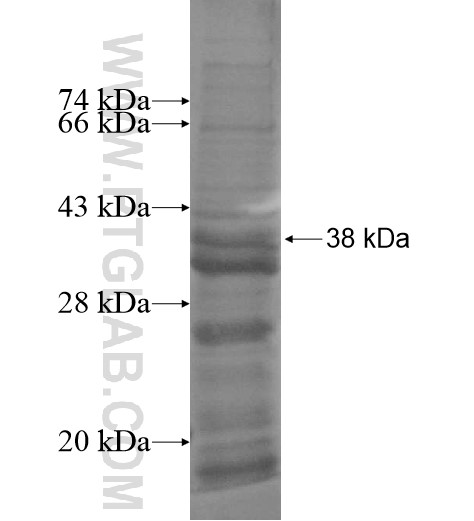 C1QTNF1 fusion protein Ag14435 SDS-PAGE C1QTNF1 fusion protein Ag14435 SDS-PAGE