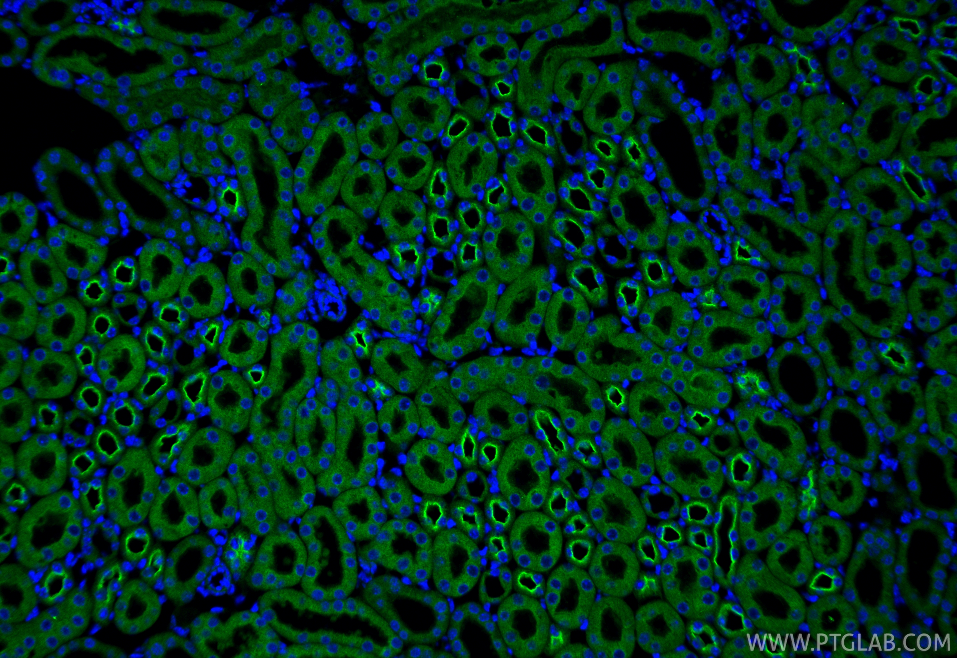 IF Staining of mouse kidney using 11414-1-AP
