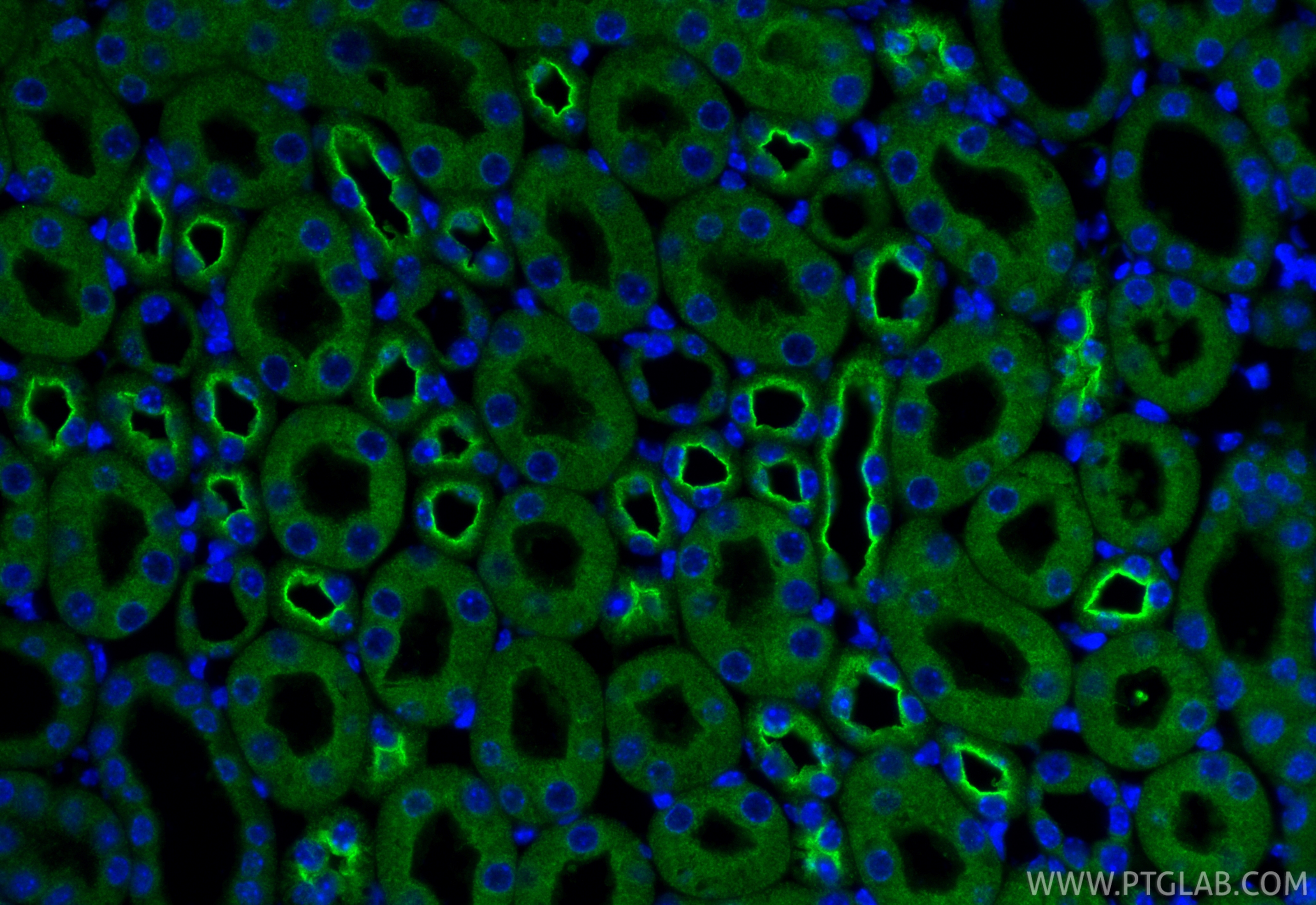 IF Staining of mouse kidney using 11414-1-AP
