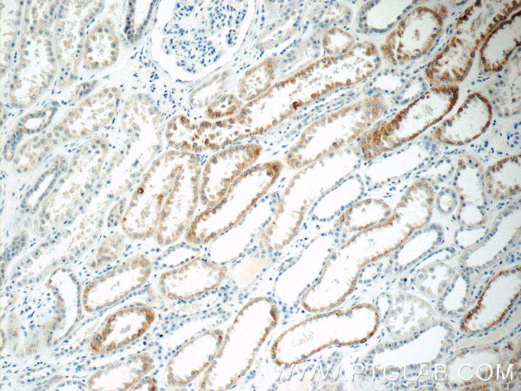 IHC staining of human kidney using 11414-1-AP (same clone as 11414-1-PBS)