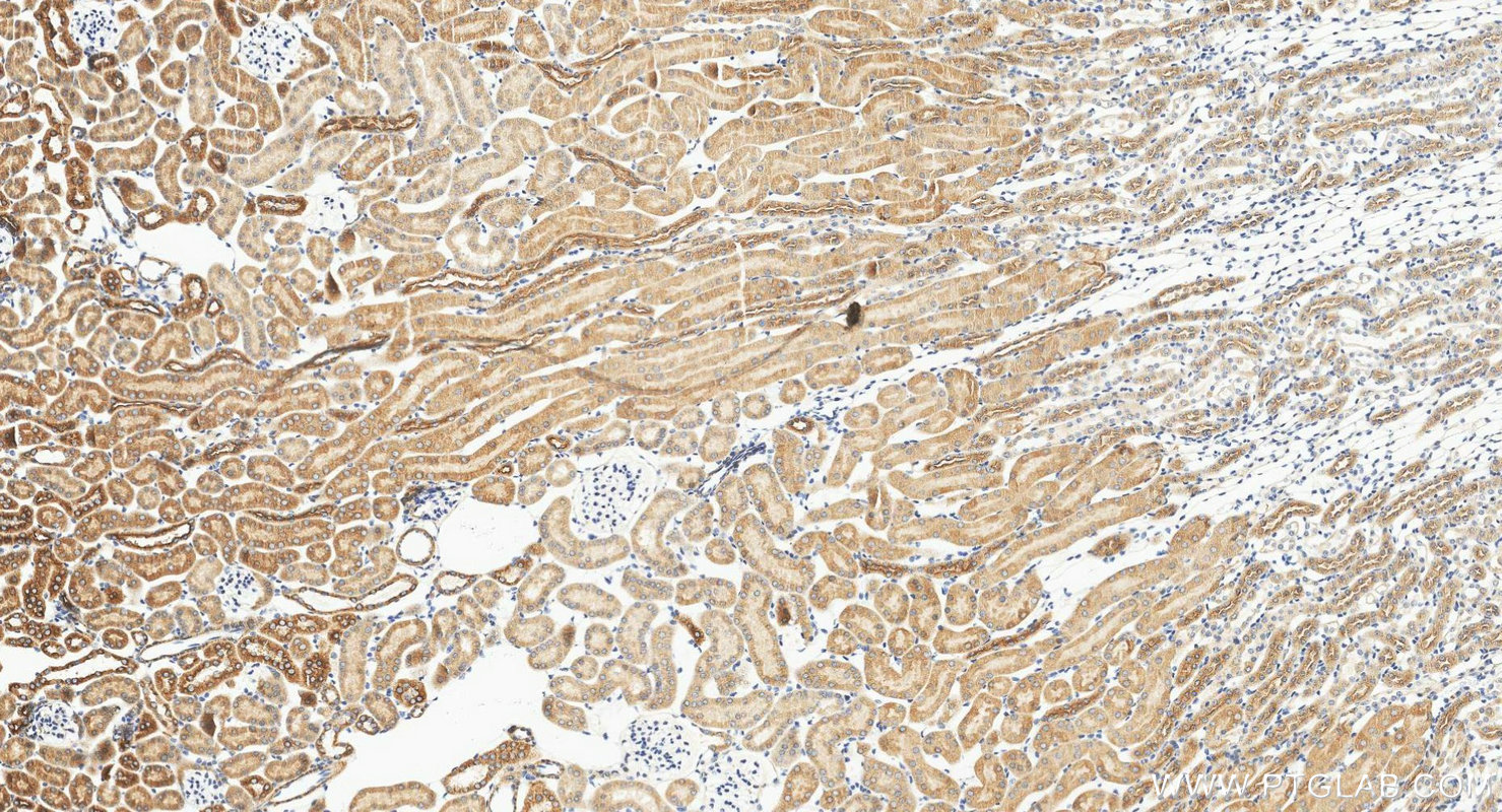 IHC staining of mouse kidney using 11414-1-AP