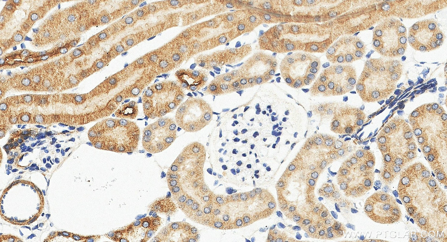 IHC staining of mouse kidney using 11414-1-AP