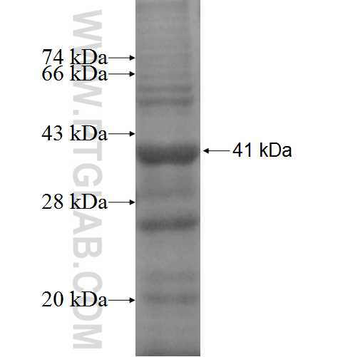 C1QTNF4 fusion protein Ag4769 SDS-PAGE C1QTNF4 fusion protein Ag4769 SDS-PAGE