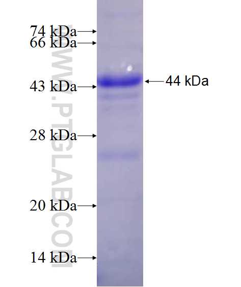 C1R fusion protein Ag11242 SDS-PAGE C1R fusion protein Ag11242 SDS-PAGE