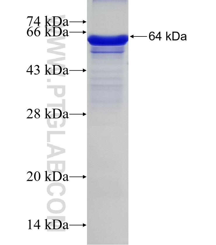 C1R fusion protein Ag11390 SDS-PAGE