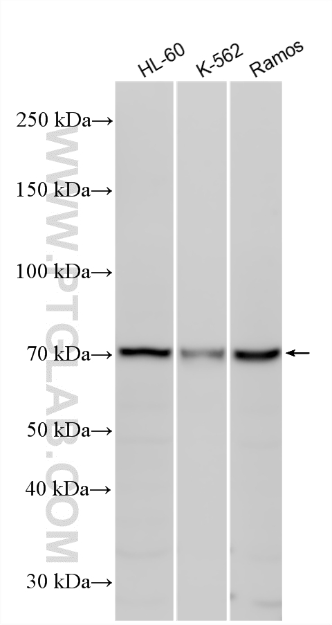 Various lysates were subjected to SDS PAGE followed by western blot with 24820-1-AP (C1RL antibody) at dilution of 1:1000 incubated at room temperature for 1.5 hours. WB analysis using 24820-1-AP