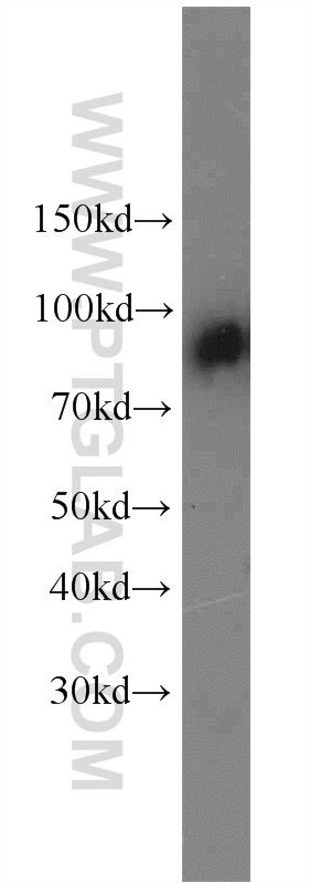 C1S Polyclonal antibody