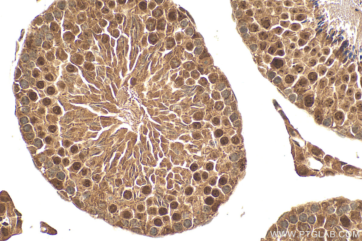 IHC staining of mouse testis using 26115-1-AP IHC staining of mouse testis using 26115-1-AP