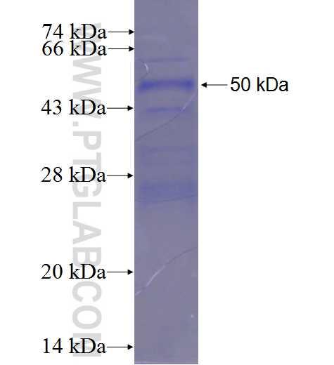 C1orf103 fusion protein Ag23512 SDS-PAGE C1orf103 fusion protein Ag23512 SDS-PAGE