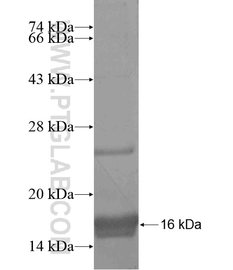 C1orf104 fusion protein Ag19806 SDS-PAGE C1orf104 fusion protein Ag19806 SDS-PAGE
