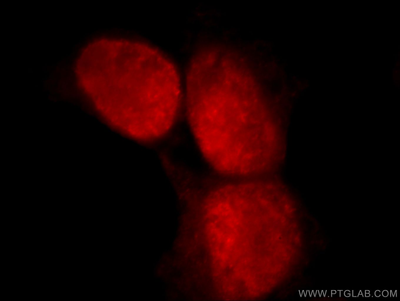 IF Staining of HEK-293 using 21506-1-AP