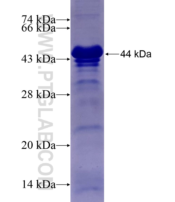 C1orf106 fusion protein Ag17321 SDS-PAGE C1orf106 fusion protein Ag17321 SDS-PAGE