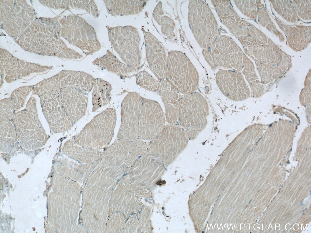 IHC staining of human skeletal muscle using 24808-1-AP