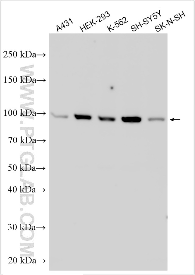 WB analysis using 27863-1-AP