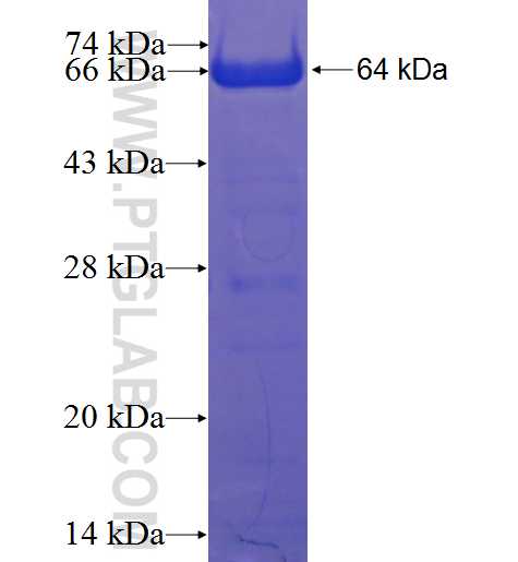C1orf113 fusion protein Ag22644 SDS-PAGE C1orf113 fusion protein Ag22644 SDS-PAGE