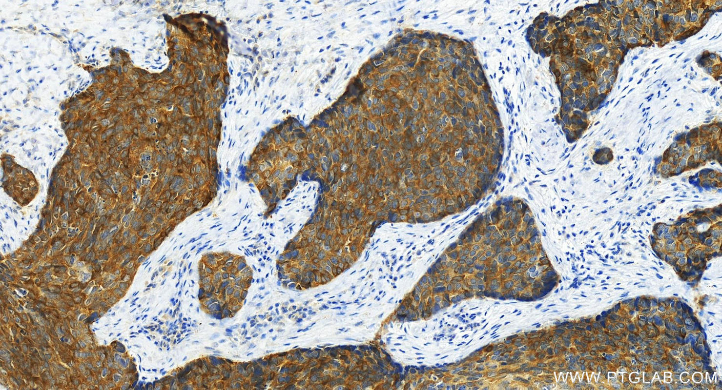 IHC staining of human brown disease using 14888-1-AP