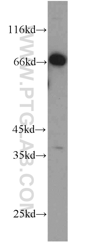 WB analysis of PC-3 using 14888-1-AP