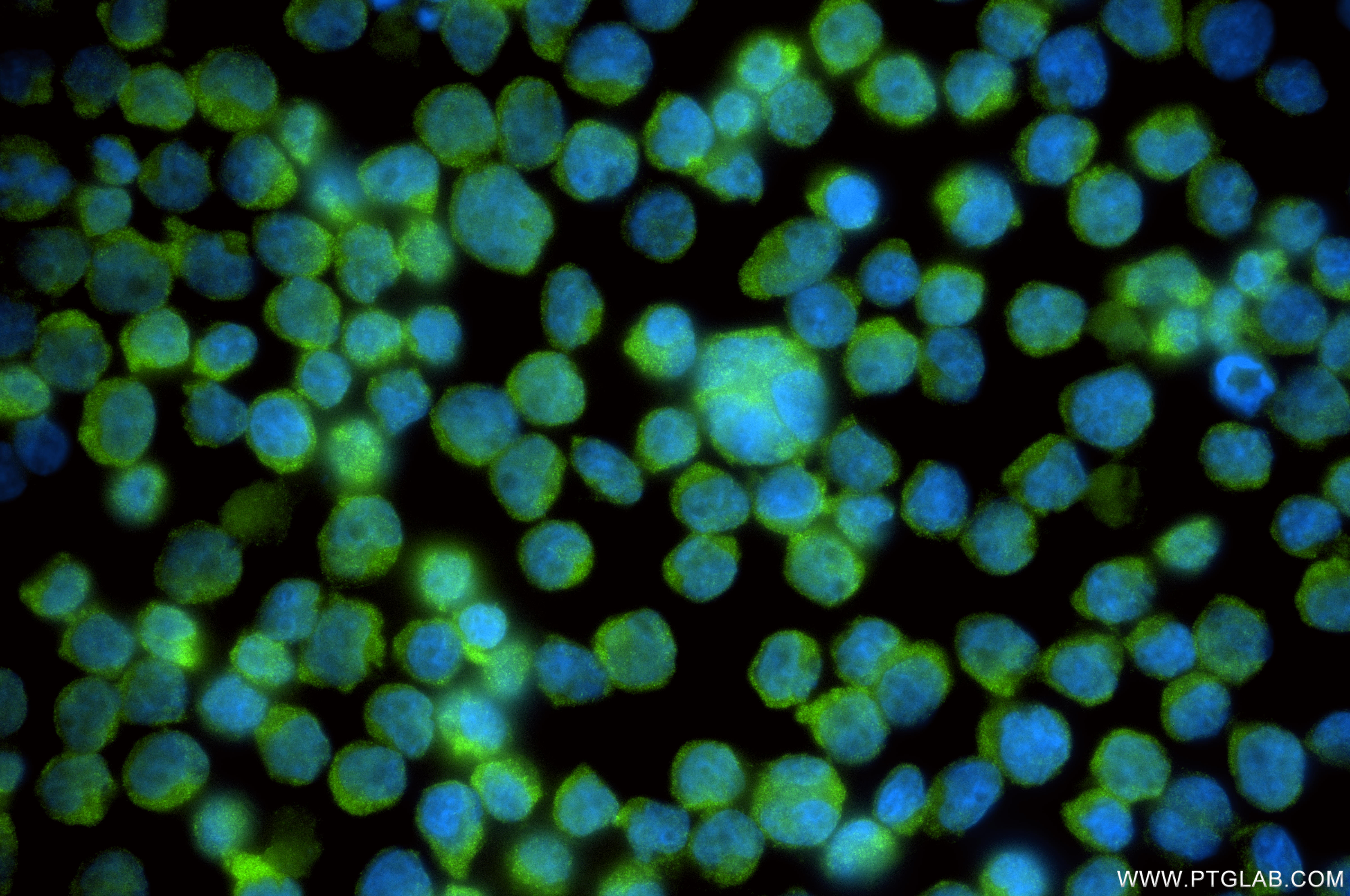 IF Staining of Jurkat using 84665-4-RR