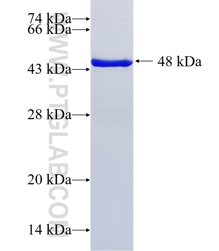 C1orf123 fusion protein Ag36156 SDS-PAGE C1orf123 fusion protein Ag36156 SDS-PAGE