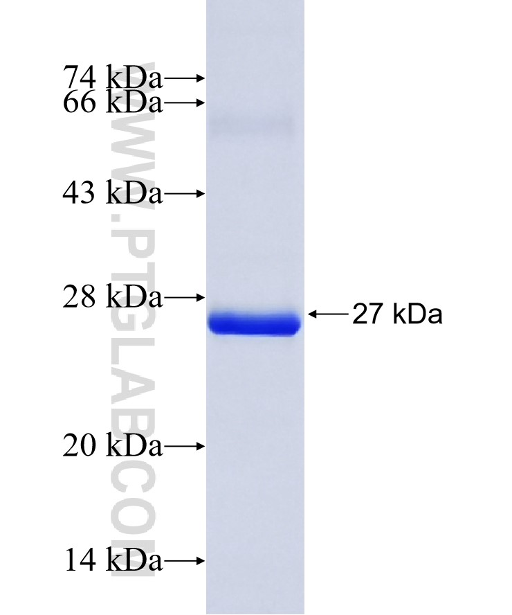 C1orf123 fusion protein Ag36187 SDS-PAGE C1orf123 fusion protein Ag36187 SDS-PAGE