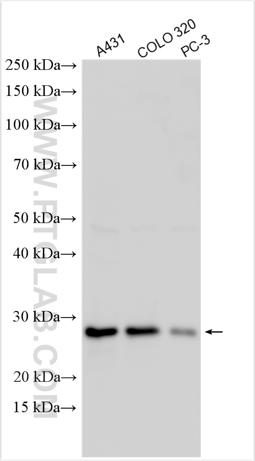 WB analysis using 25361-1-AP