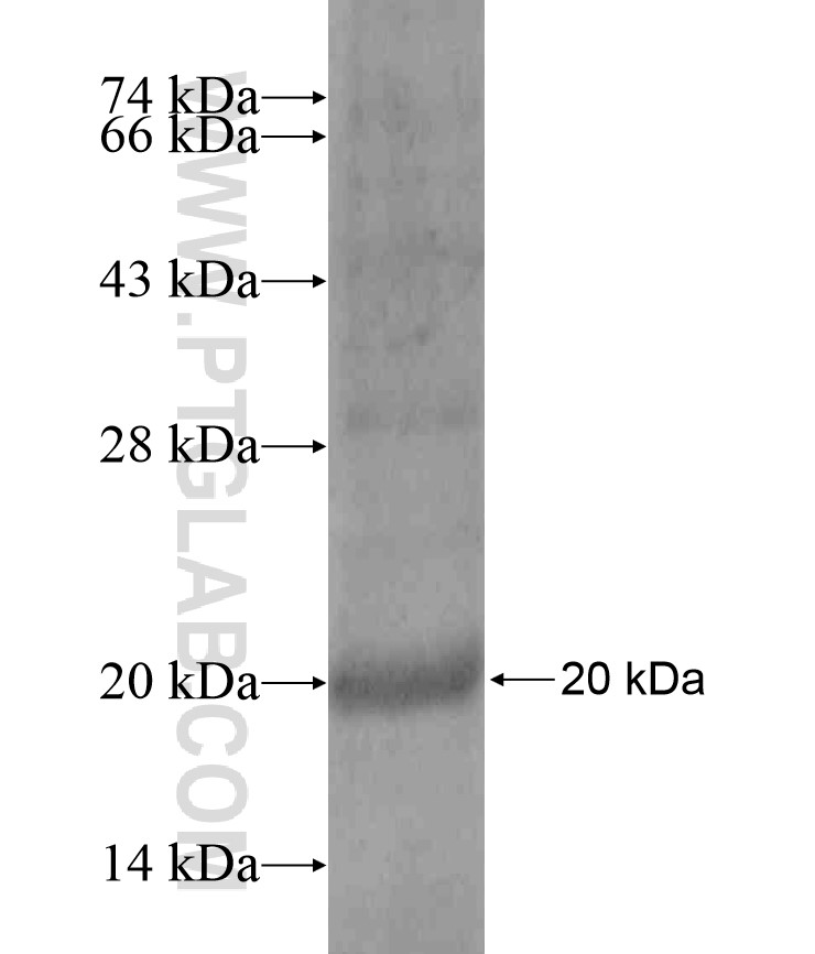 C1orf212 fusion protein Ag18051 SDS-PAGE C1orf212 fusion protein Ag18051 SDS-PAGE
