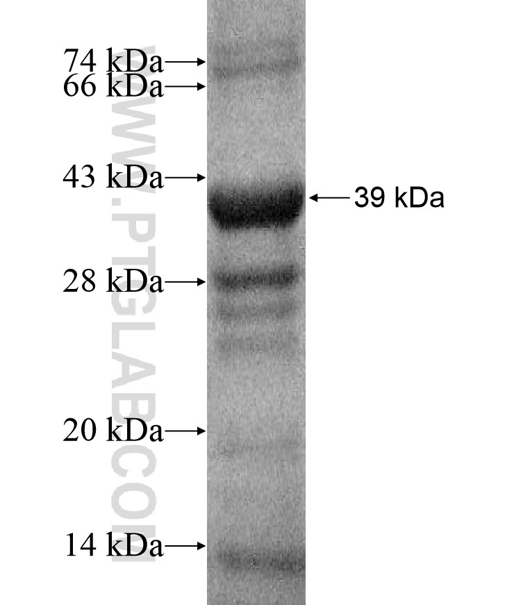 C1orf222 fusion protein Ag17404 SDS-PAGE C1orf222 fusion protein Ag17404 SDS-PAGE