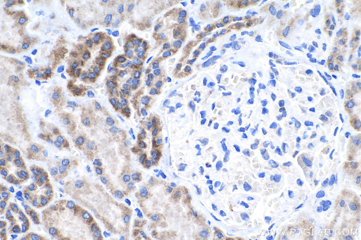 IHC staining of human kidney using 24209-1-AP