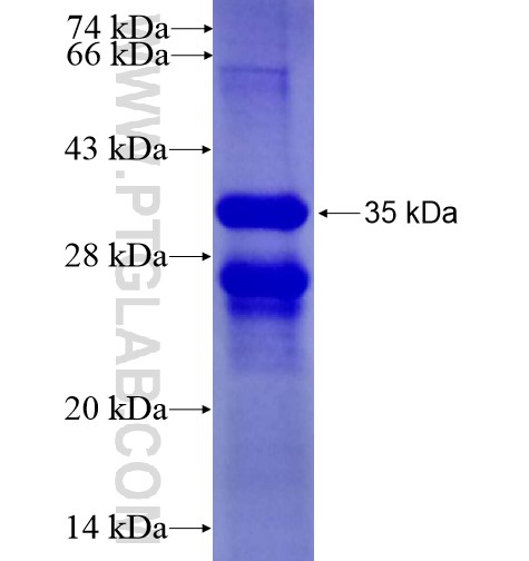 C1orf35 fusion protein Ag14374 SDS-PAGE